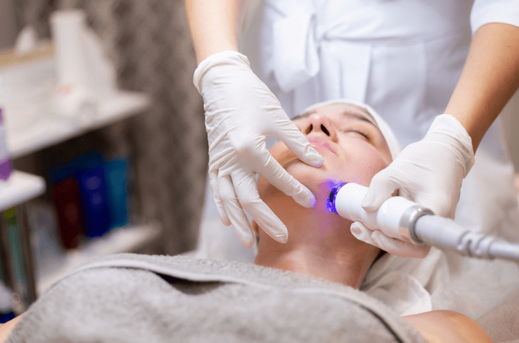 Laser Treatments